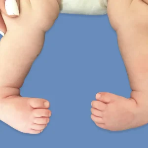 6082dfa9f934d72e42b2bf85_pieequinovarp-diegoortizortopediainfantil
