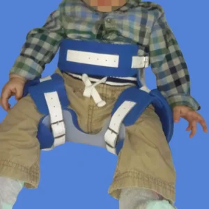 61eb20e0601753d0fdc1a4bd_displasia-diegoortizortopediainfantil